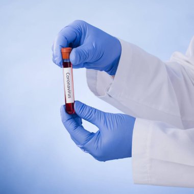 Yeni hızla yayılan Coronavirus, Coronavirus 2019-nCoV kan örneği için pozitif kan testi sonucu. Corona virüsü salgını. Salgın Virüsü Solunum Sendromu.