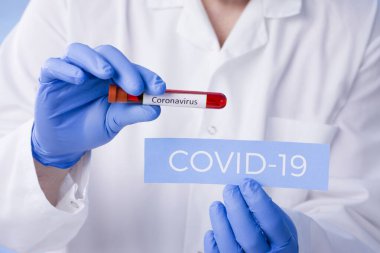 Yeni hızla yayılan Coronavirus, Coronavirus 2019-nCoV kan örneği için pozitif kan testi sonucu. Corona virüsü salgını. Salgın Virüsü Solunum Sendromu.