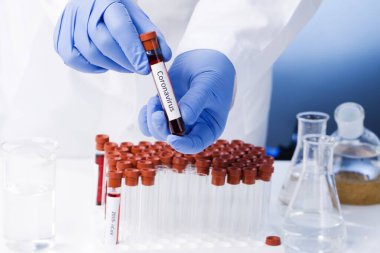 Yeni hızla yayılan Coronavirus, Coronavirus 2019-nCoV kan örneği için pozitif kan testi sonucu. Corona virüsü salgını. Salgın Virüsü Solunum Sendromu.