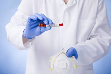 Coronavirus 2019-ncov kan örneği. Corona virüsü salgını. Salgın Virüsü Solunum Sendromu.