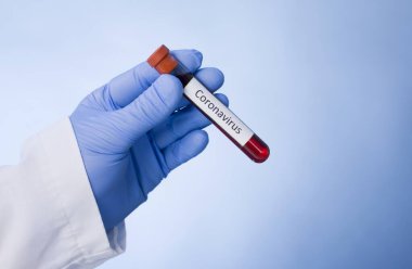 Coronavirus 2019-ncov kan örneği. Corona virüsü salgını. Salgın Virüsü Solunum Sendromu.
