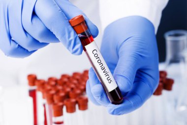 Laboratuvardaki Corona Virüsü. Kan Testi yapan bir bilim adamı. Yeni Salgın Coronavirüs 2019 nCoV