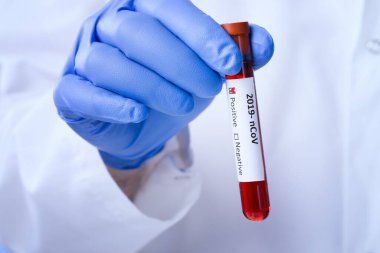 Laboratuvardaki Corona Virüsü. Kan Testi yapan bir bilim adamı. Yeni Salgın Coronavirüs 2019 nCoV