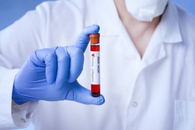 Coronavirus kan testi sonucu vakum test tüpündeki koronavirüs enfeksiyonu laboratuardaki Coronavirus metniyle doktorların ellerinde..