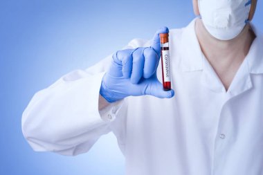 Coronavirus kan testi sonucu vakum test tüpündeki koronavirüs enfeksiyonu laboratuardaki Coronavirus metniyle doktorların ellerinde..
