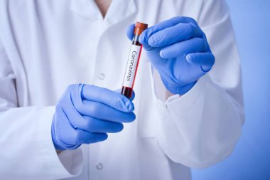 Coronavirus kan testi sonucu vakum test tüpündeki koronavirüs enfeksiyonu laboratuardaki Coronavirus metniyle doktorların ellerinde..