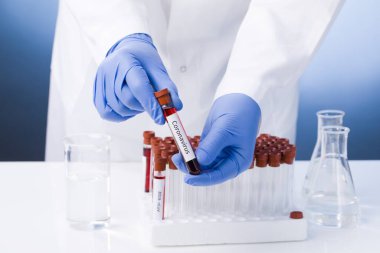 Coronavirus blood test result, blood infected with coronavirus in vacuum test tube in doctors hands with text Coronavirus in laboratory. clipart