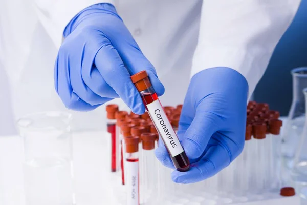 Корона Вирус Лаборатории Ученый Проводит Анализ Крови Новый Эпидемический Коронавирус — стоковое фото