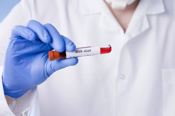 Resultado Teste Sangue Coronavírus Sangue Infectado Com Coronavírus Tubo Teste — Fotografia de Stock