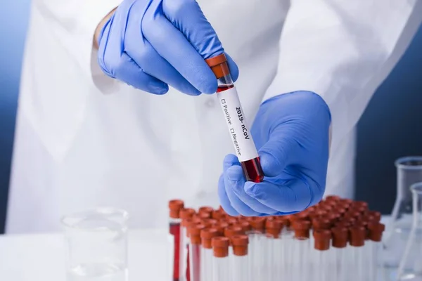 Positive Blood Test Result New Rapidly Spreading Coronavirus Coronavirus 2019 — Stock Photo, Image