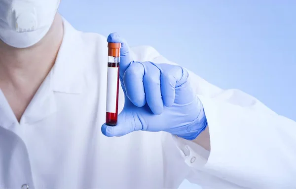 Pozitivní Výsledky Krevních Testů Nový Rychle Šířící Coronavirus Coronavirus 2019 — Stock fotografie