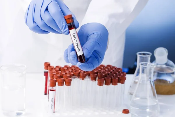 Resultado Positivo Teste Sangue Para Nova Rápida Disseminação Coronavirus Coronavirus — Fotografia de Stock