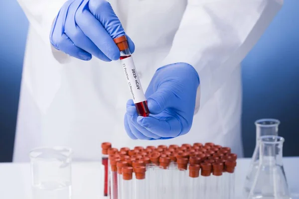 Koronavirus 2019 Ncov Blood Sample Koronový Virus Vypukl Syndrom Respiračního — Stock fotografie