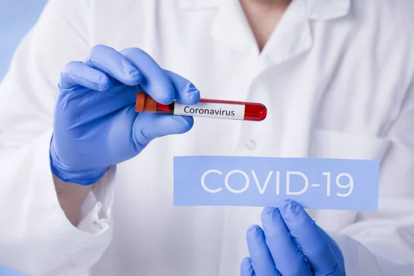 Corona Virus Lab Науковець Проводить Аналіз Крові New Epidemic Coronavirus — стокове фото