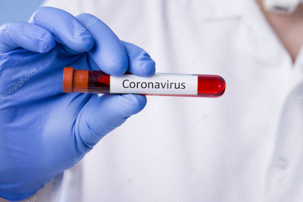 Coronavirus blood test result, blood infected with coronavirus in vacuum test tube in doctors hands with text Coronavirus in laboratory. Diagnosis, detection, analysis of Chinese coronavirus. Epidemic