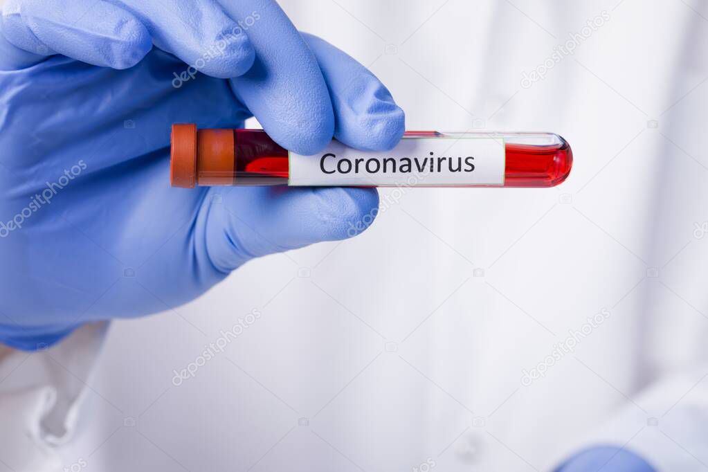 Coronavirus blood test result, blood infected with coronavirus in vacuum test tube in doctors hands with text Coronavirus in laboratory.