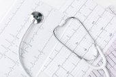Stethoskop auf Papier mit Kardiogramm auf weißem Hintergrund    