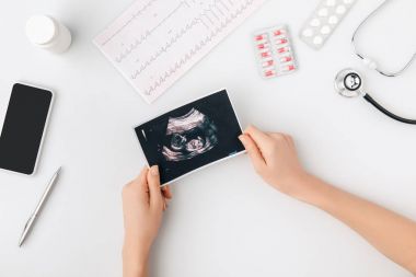 Beyaz arka plan üzerinde izole iç organ tarama ile fotoğraf tutan el Üstten Görünüm   