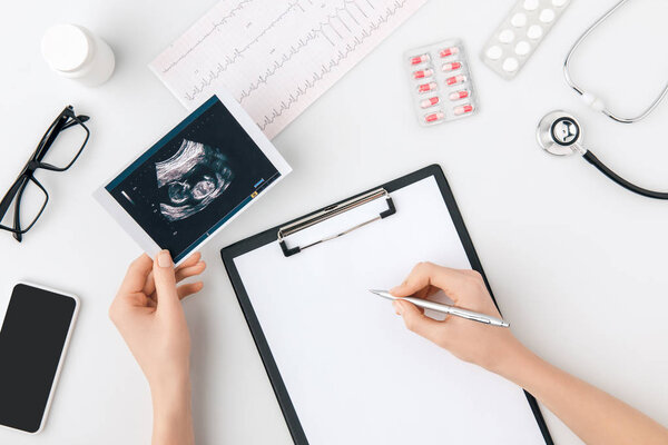 top view of hand with pen over paper on folder and photo with internal organ screening in another one isolated on white background    