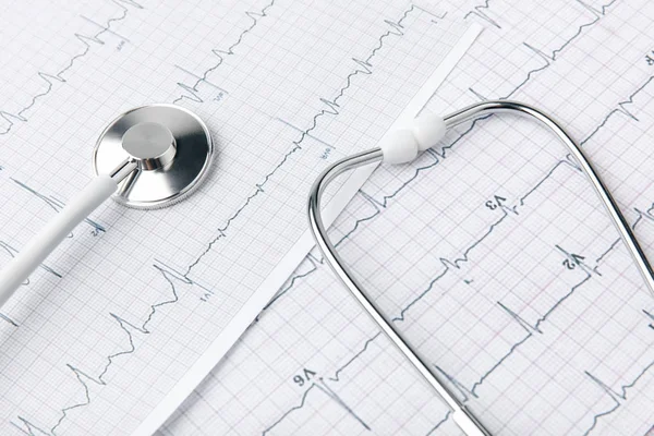 Beyaz arka plan üzerinde izole kardiyogram ile kağıt üzerinde döşeme stetoskop     
