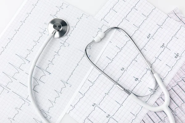 Stethoscoop Opleggen Van Papier Met Cardiogram Geïsoleerd Witte Achtergrond — Stockfoto