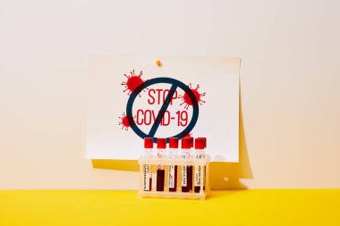 paper with stop covid-19 lettering near test tubes with coronavirus test on white and yellow clipart
