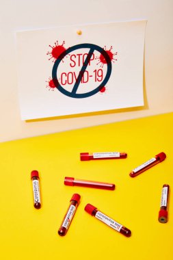 Beyaz ve sarı harf üzerinde Coronavirus test harfleri olan test tüplerinin yanındaki covid-19 'u durdurun.