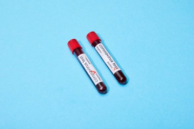 Kan örnekleriyle test tüpleri ve mavi harflerle Coronavirus test harfleri. 