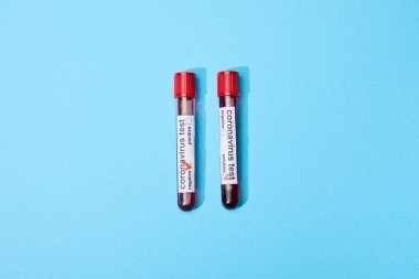 Mavi renkli test tüpleri ve koronavirüs test harfleriyle test tüplerinin üst görünümü 