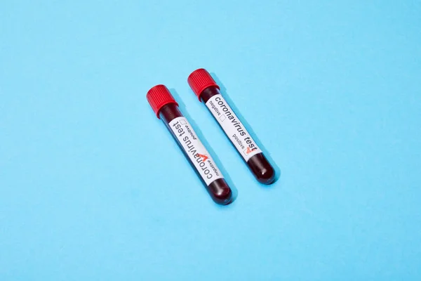 Probówki Próbkami Krwi Literami Testowymi Koronawirusu Niebiesko — Zdjęcie stockowe