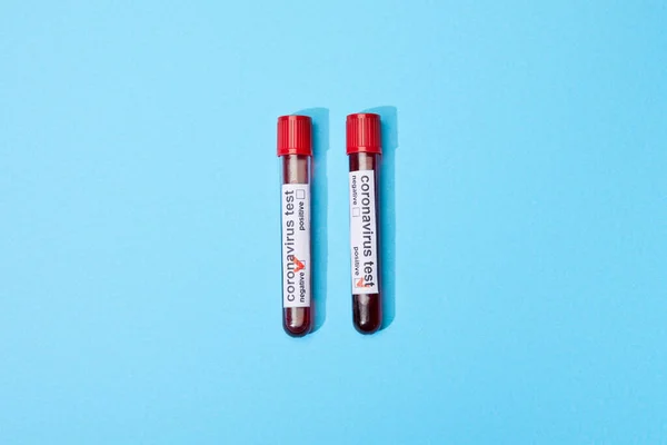 Top View Test Tubes Samples Coronavirus Test Lettering Blue — Stock Photo, Image