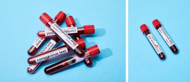 mavi üzerinde test tüpleri ve koronavirüs test harfleri olan test tüpleri kolajı 