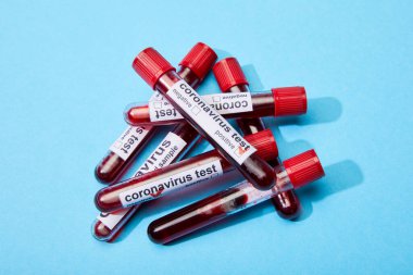 Kan örnekleriyle test tüpleri ve mavi harflerle Coronavirus test harfleri. 