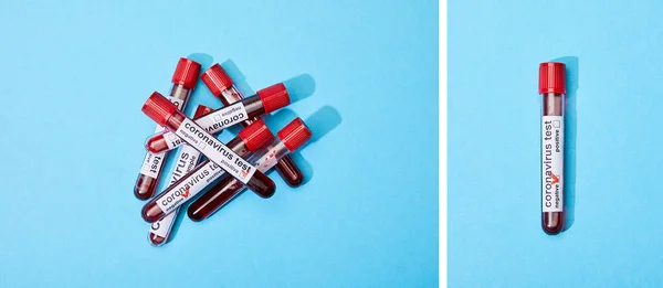 Collage Tubos Ensayo Con Muestras Sangre Letras Análisis Coronavirus Azul — Foto de Stock