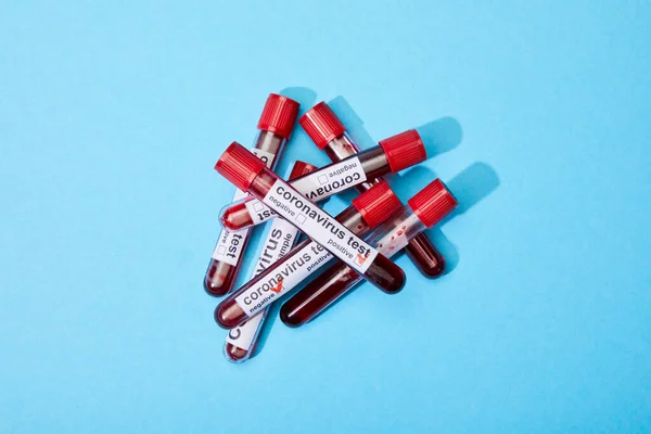 Top View Test Tubes Blood Samples Coronavirus Test Lettering Blue — Stock Photo, Image