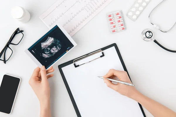 Vista dall'alto di mano con penna su carta su cartella e foto con screening organo interno in un altro isolato su sfondo bianco — Foto stock