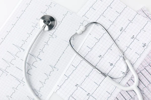 Stéthoscope posé sur papier avec cardiogramme isolé sur fond blanc — Photo de stock