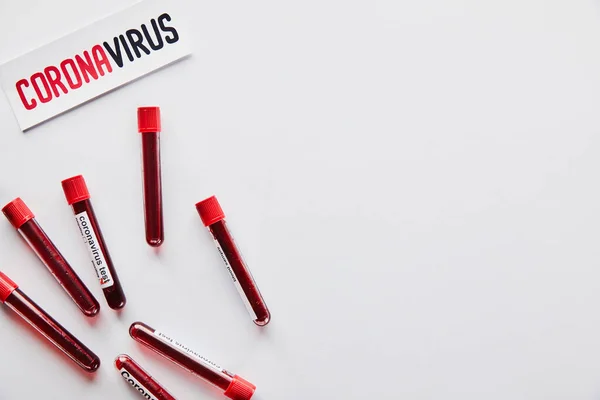 Visão superior dos tubos de ensaio com amostras de sangue e teste de coronavírus perto de papel com letras de coronavírus sobre branco — Fotografia de Stock