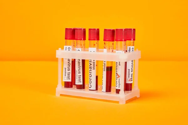 Tubos de ensayo con muestras de sangre y letras de análisis de coronavirus en naranja - foto de stock
