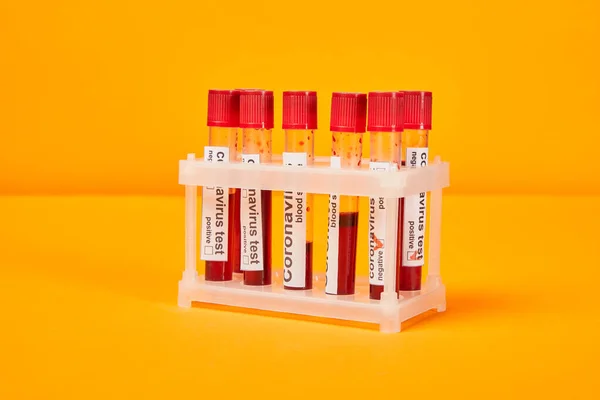 Tubos de ensayo con muestras de sangre y letras de análisis de coronavirus en naranja - foto de stock