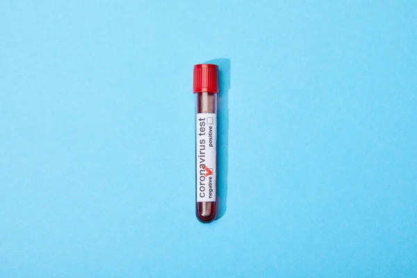 Vue du dessus du tube à essai avec échantillon de sang et lettrage de test de coronavirus sur bleu — Photo de stock