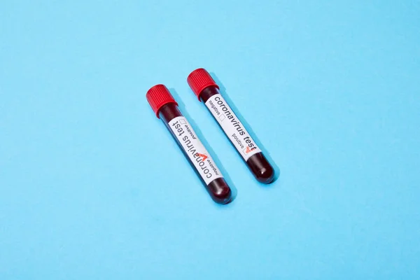 Éprouvettes avec échantillons de sang et lettrage de test de coronavirus sur bleu — Photo de stock