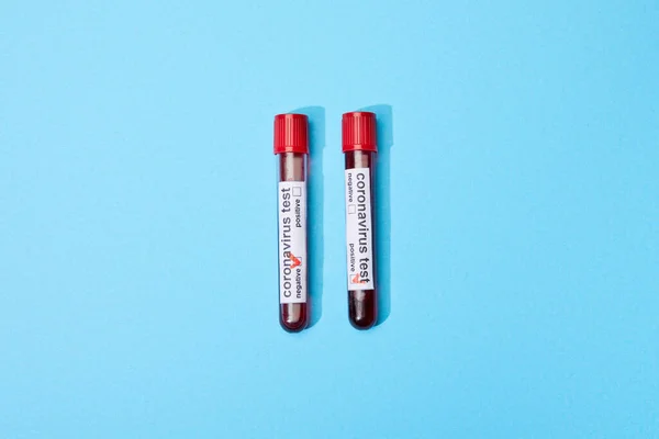 Vue du dessus des éprouvettes avec échantillons et lettrage d'essai de coronavirus sur bleu — Photo de stock