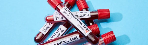 Inyección panorámica de tubos de ensayo con muestras de sangre y letras de análisis de coronavirus en azul - foto de stock