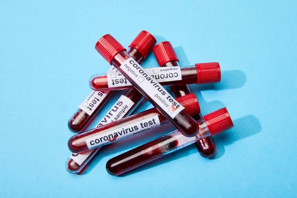 Reagenzgläser mit Blutproben und Coronavirus-Test-Schriftzug auf blau — Stockfoto