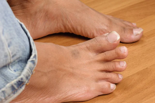 Male foot — Stock Photo, Image