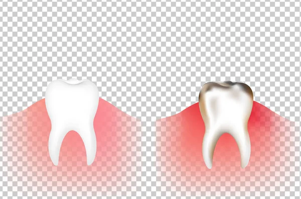 Degrade kafes ile diş — Stok Vektör