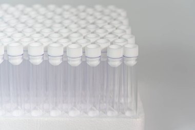 Laboratuvarda yeni vakum venipunktur kan test tüpleri grubu