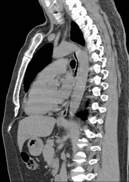 Gros plan sur la radiographie — Photo