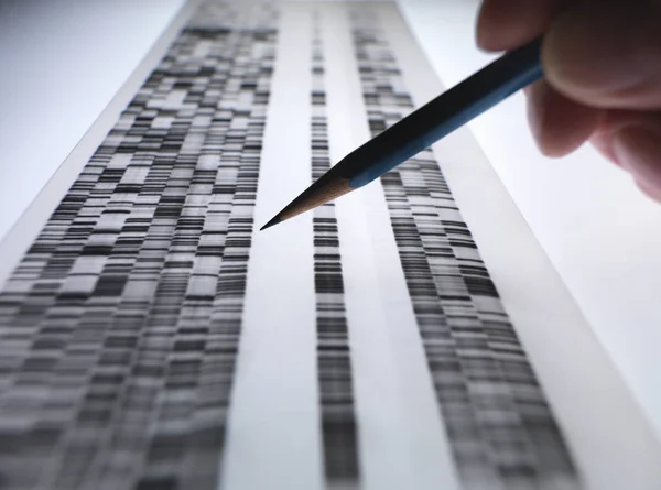 Scientist Viewing Dna Gel Used Genetics Forensic Pharma Research Biotechnology — Stock Photo, Image